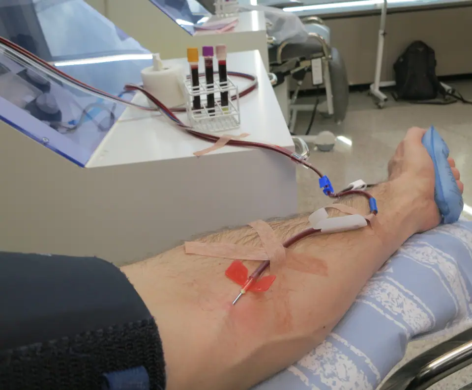 Brazo conectado a un equipo de donación de plaquetas en un centro de donación de sangre